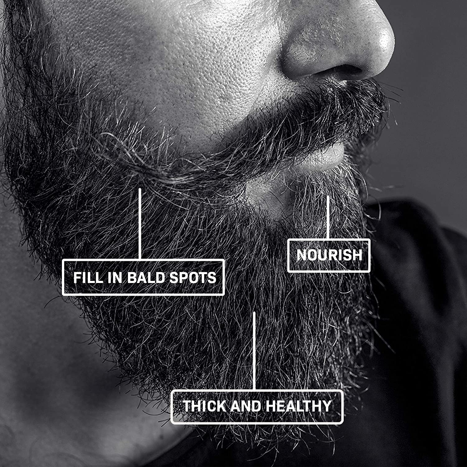 BEARD GROWTH KIT - DERMA ROLLER FOR BEARD GROWTH AND BEARD GROWTH SERUM
