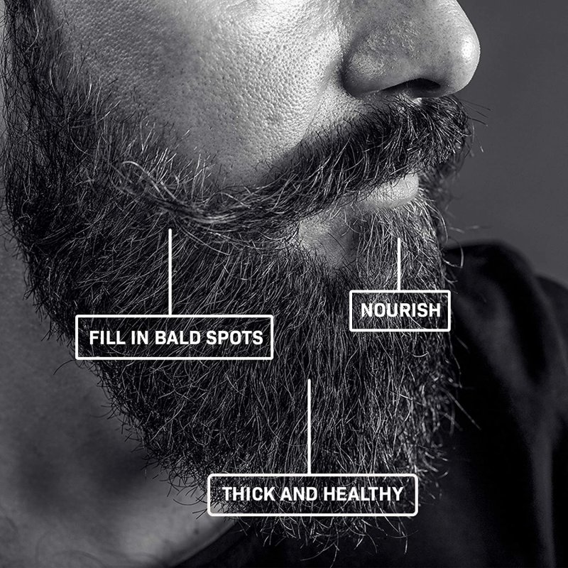 BEARD GROWTH KIT - DERMA ROLLER FOR BEARD GROWTH AND BEARD GROWTH SERUM