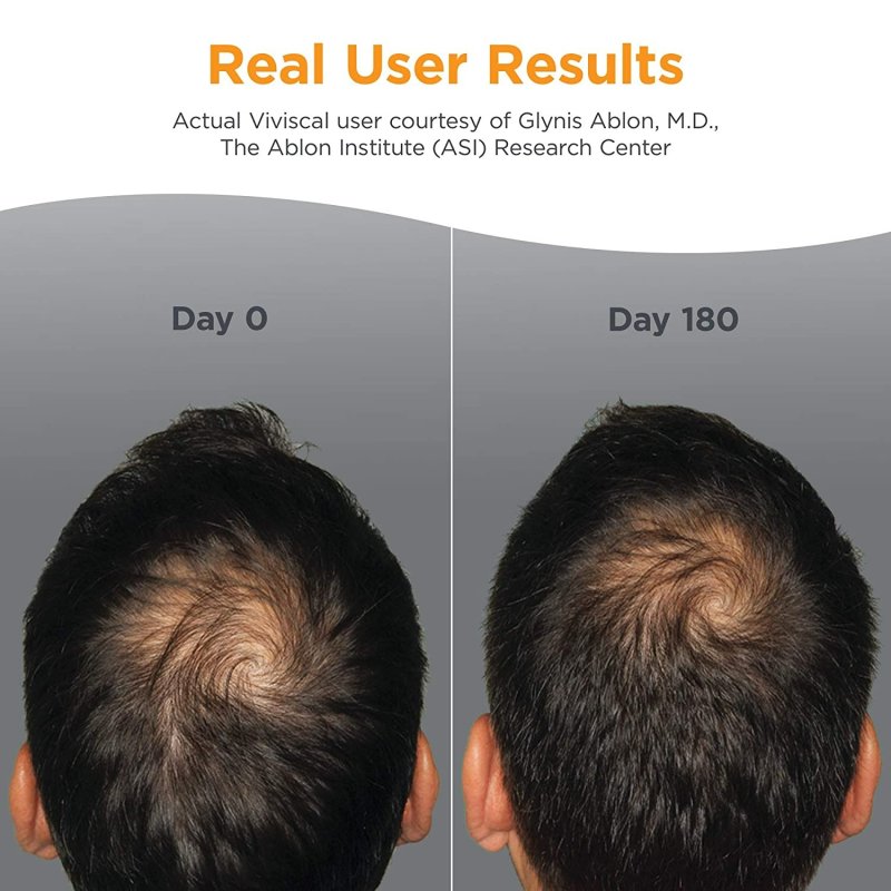 VIVISCAL MAN HAIR GROWTH SUPPLEMENTS - 60 TABLET