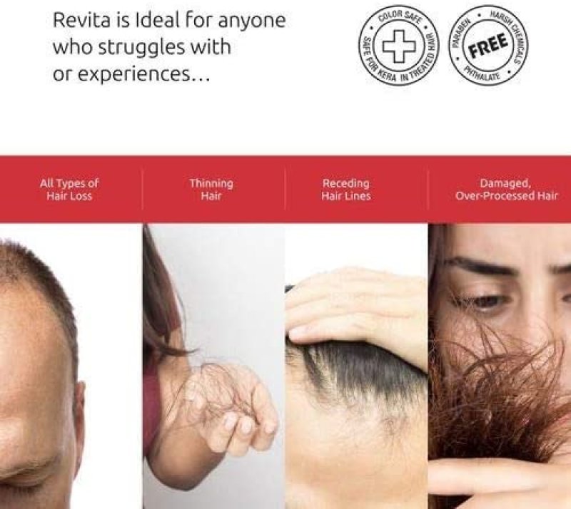 HAIR THINNING & HAIR GROWTH KIT W/REVITA HAIR STIMULATING SHAMPOO AND REVITA HAIR GROWTH SUPPLEMENT TABLETS FOR MEN & WOMEN