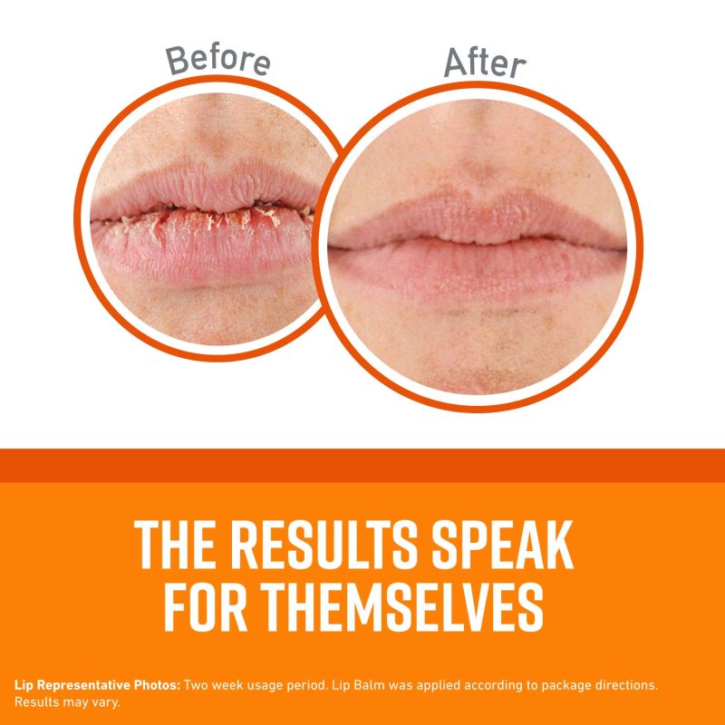 O'KEEFFE'S UNSCENTED LIP REPAIR LIP BALM - 2 ADET