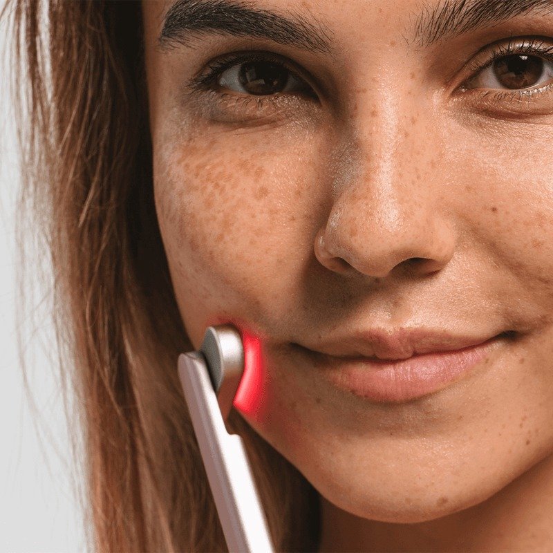 SOLAWAVE ADVANCED SKINCARE WAND WITH RED LIGHT THERAPY