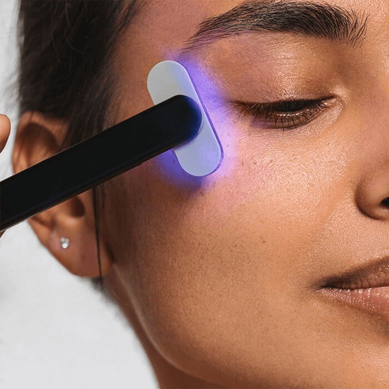 SOLAWAVE ANTI-BREAKOUT SKINCARE WAND WITH BLUE LIGHT THERAPY