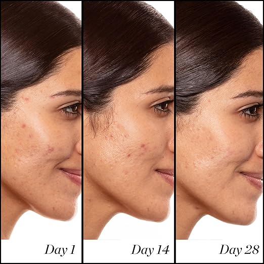 SUNDAY RILEY A+ HIGH-DOSE ANTI AGING RETINOL SERUM