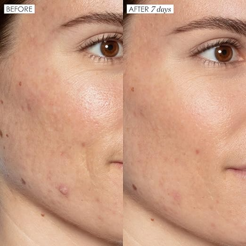 SUNDAY RILEY GOOD GENES ALL-IN-ONE LACTIC ACID TREATMENT FACE SERUM
