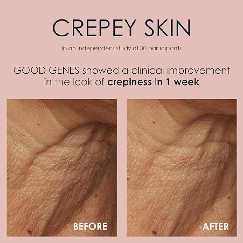 SUNDAY RILEY GOOD GENES ALL-IN-ONE LACTIC ACID TREATMENT FACE SERUM