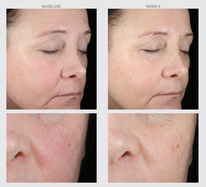 THE SKIN SPOT HA BOOST HYDRATING COPPER FIRMING SERUM