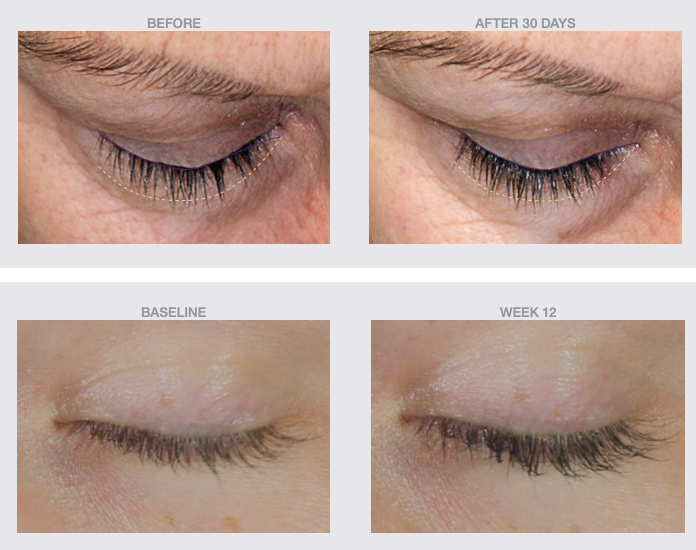 THE SKIN SPOT LASH BOOST PEPTIDE GROWTH LASH/BROW SERUM