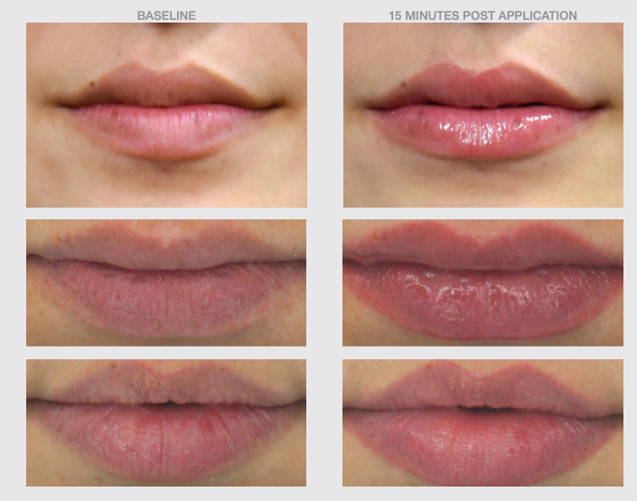 THE SKIN SPOT LIP BOOST SPF30 PLUMPING HYDRATING SERUM