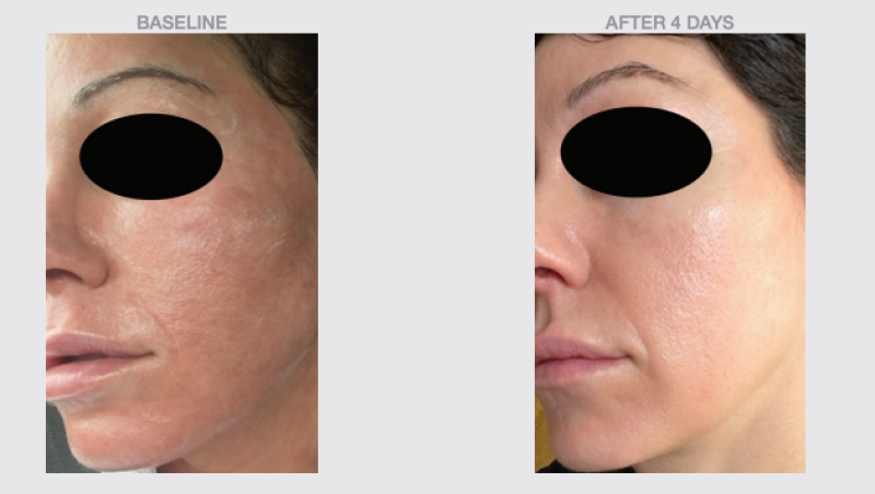 THE SKIN SPOT PHYTO BALANCE ANTIOXIDANT SOOTHING SERUM
