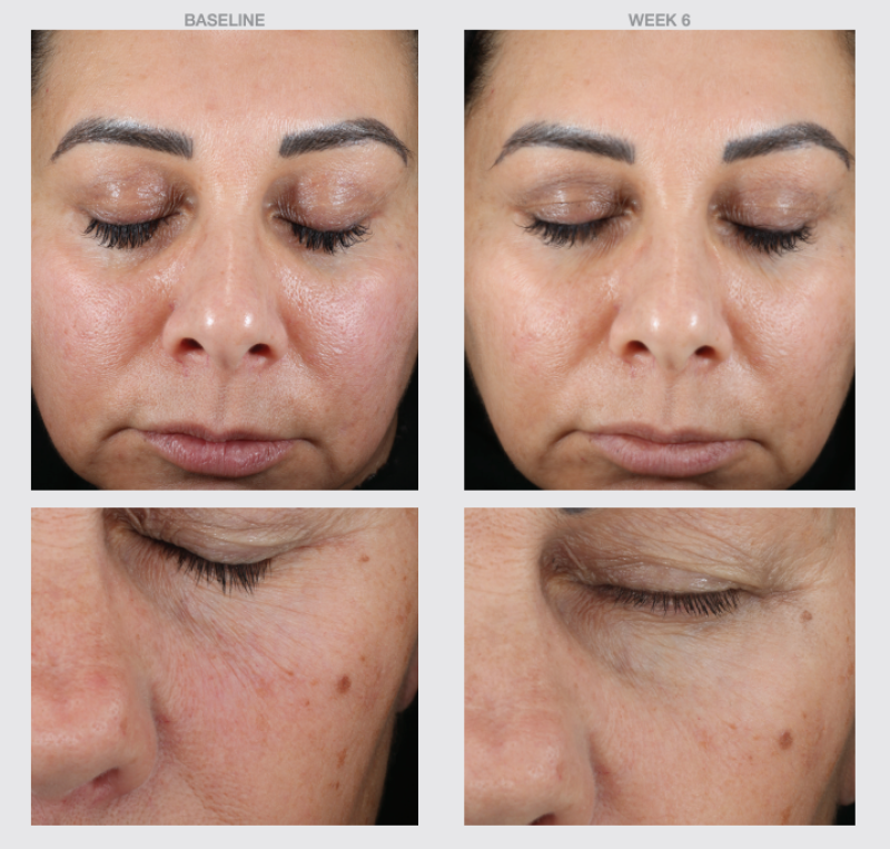 THE SKIN SPOT RETINOL+ SKIN SMOOTHING BRIGHTENING CREAM