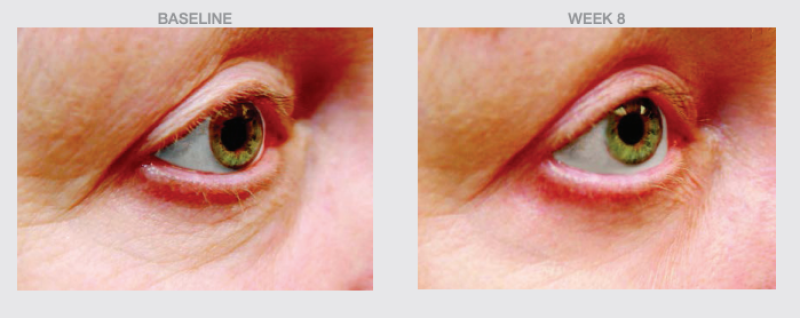 THE SKIN SPOT SMOOTH EYE FIRM & BRIGHTEN PEPTIDE CREAM