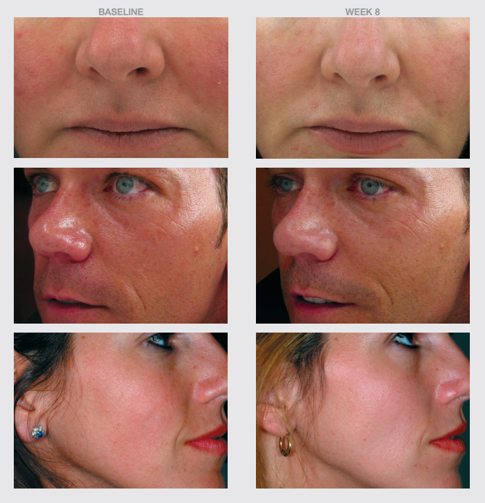 THE SKIN SPOT TRIPLE ANTIOX RESVERATROL HYDRATING CREAM