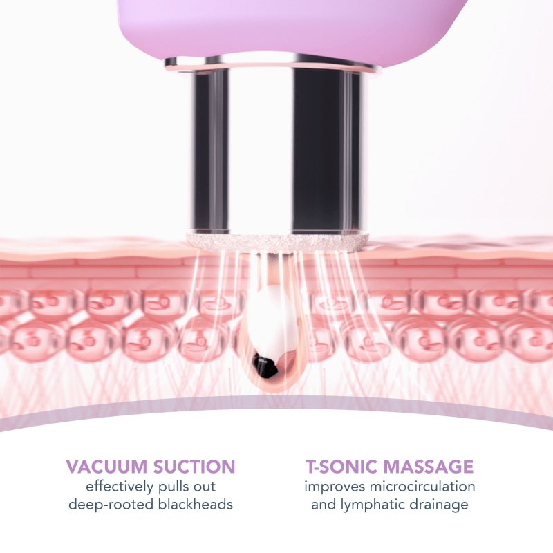 FOREO KIWI DERMA MICRODERMABRASION MACHINE BLACK HEAD REMOVER FOR FACE NOSE