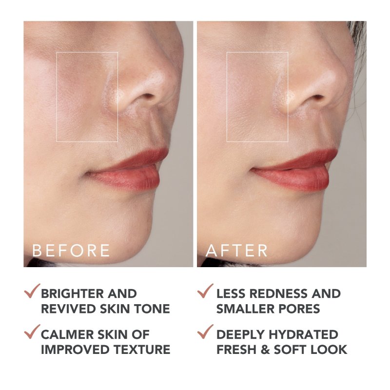 FOREO SUPERCHARGED BARRIER RESTORING ESSENCE MIST - SKIN HYDRATION MIST