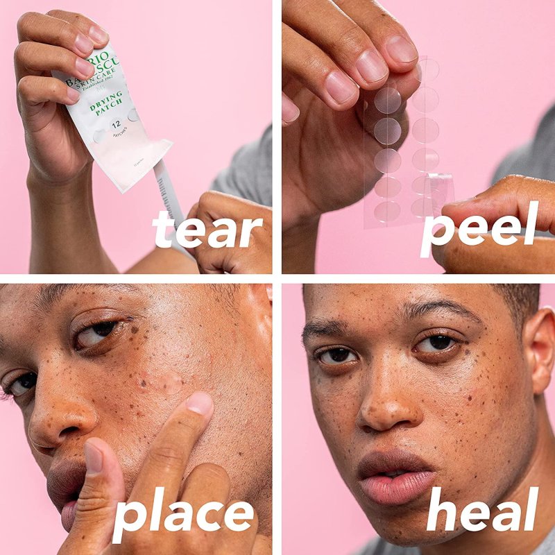 MARIO BADESCU DRYING PATCH 60 PIECE CLEAR INVISIBLE DAY NIGHT BLEMISH WHITEHEADS