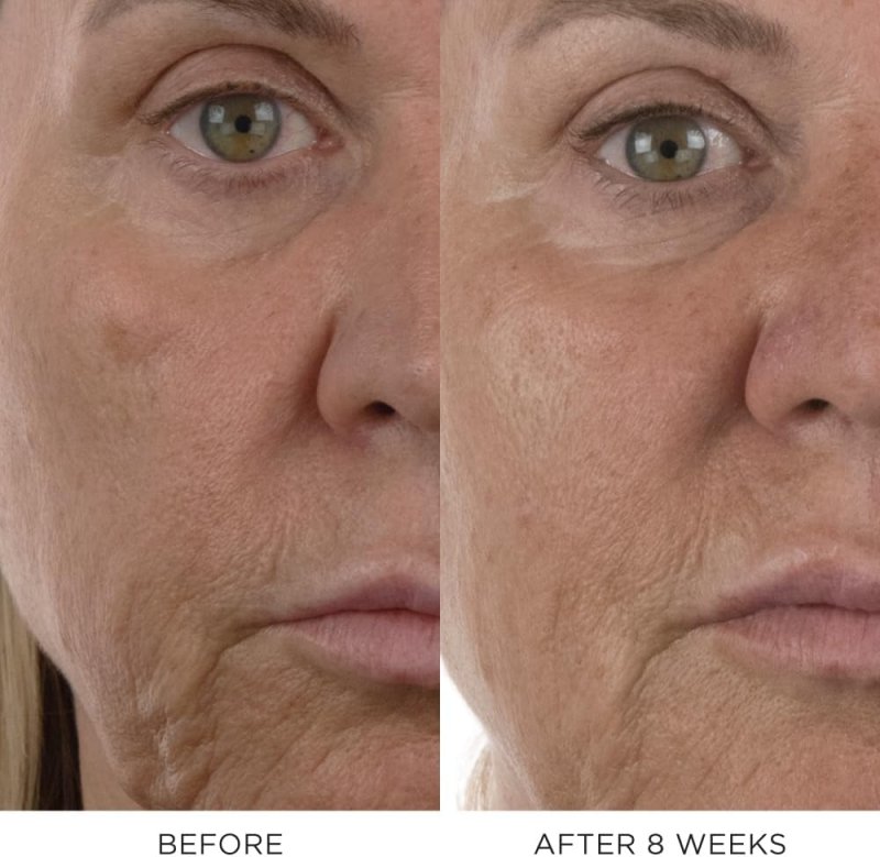 LUXURY NOBLE PANACEA  SKINCARE SERUM FOR RADIANT SKIN