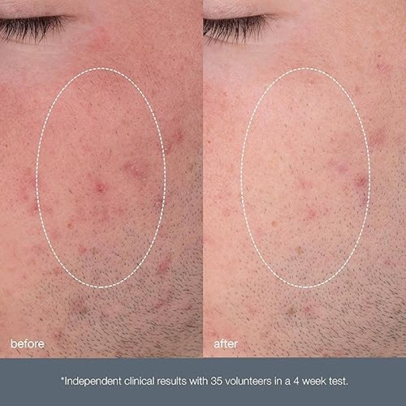 DERMALOGICA DAILY MICROFOLIANT FACE EXFOLIATOR SCRUB POWDER SALICYLIC ACID PAPAYA ENZYME BRIGHTER SMOOTHER SKIN DAILY