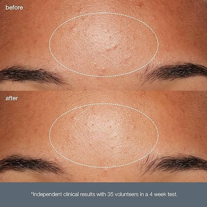 DERMALOGICA DAILY MICROFOLIANT FACE EXFOLIATOR SCRUB POWDER SALICYLIC ACID PAPAYA ENZYME BRIGHTER SMOOTHER SKIN DAILY