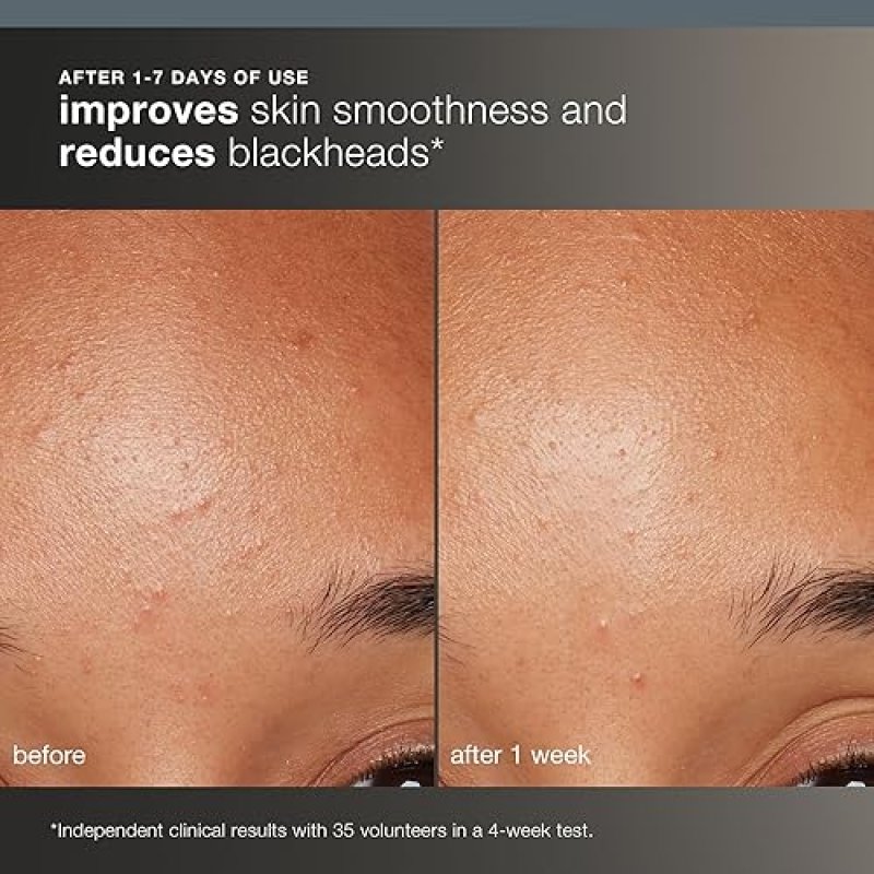 DERMALOGICA DAILY MICROFOLIANT: BRIGHTEN & SMOOTH SKIN WITH SALICYLIC ACID & PAPAYA