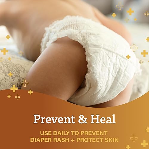 BAYER-BERROCCA  A+D ORIGINAL DIAPER RASH OINTMENT, PREVENTS & PROTECTS DIAPER RASH, MOISTURIZES & HEALS DRY SKIN WIT