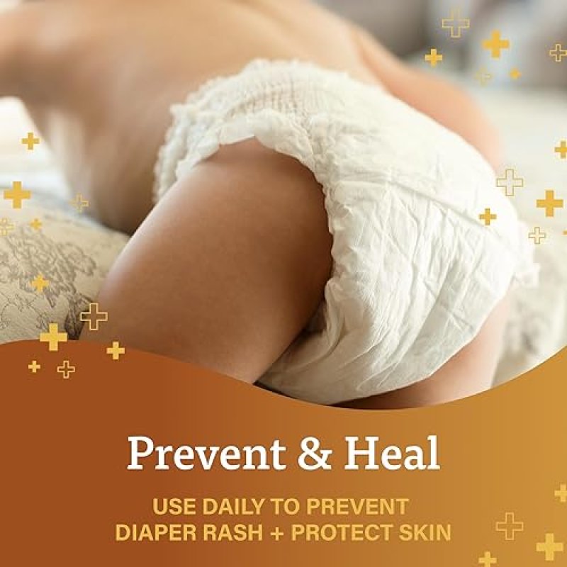 BAYER-BERROCCA  A+D ORIGINAL DIAPER RASH OINTMENT, PREVENTS & PROTECTS DIAPER RASH, MOISTURIZES & HEALS DRY SKIN WIT