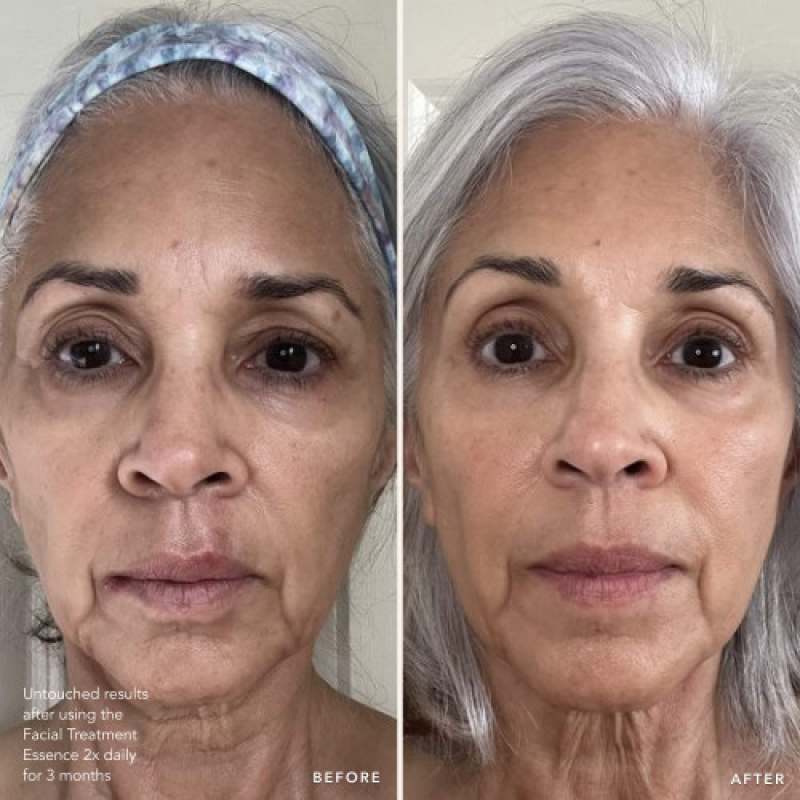 SK-II YEARS YOUNGER WITH 1 USE  GLOW UP DUO