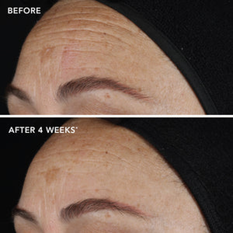 IMAGE SKINCARE AGELESS+ RETINOL PURE LIQUID RETINOL 0.1% (TRAVEL SIZE)