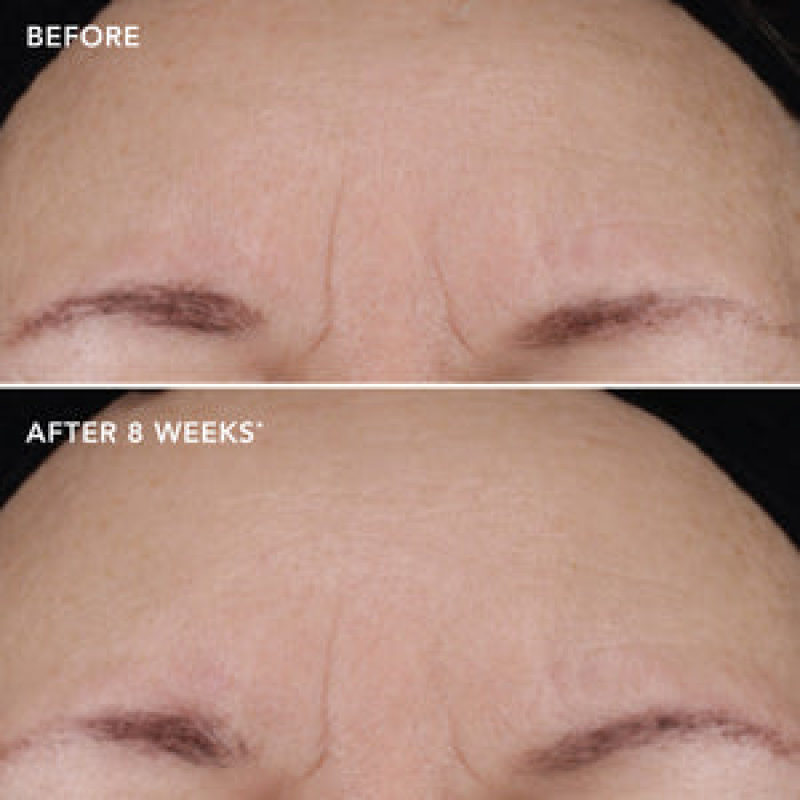 IMAGESKINCARE AGELESS+ RETINOL TREATMENT CRèME 1.2% RETINOL COMPLEX