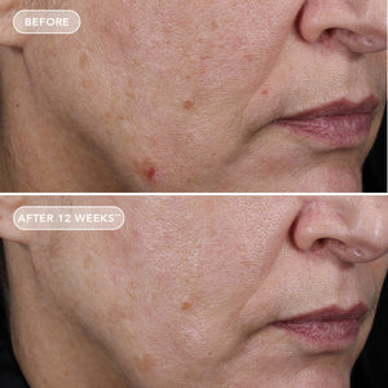 IMAGE SKINCARE AGELESS+ RETINOL PURE LIQUID RETINOL 0.75%