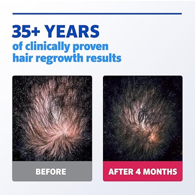ROGAINE 5 MINOXIDIL EXTRA STRENGTH HAIR REGROWTH SOLUTION, UNSCENTED, 2 FL OZ
