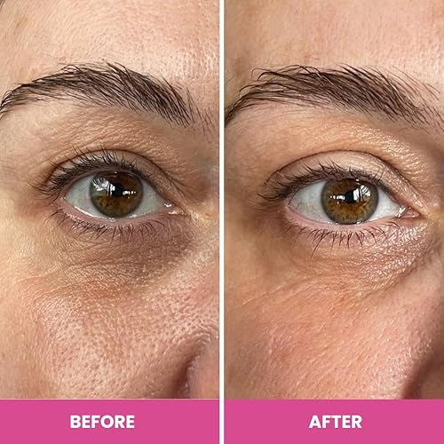 PRIMEEYES HYDRATING UNDER EYE CREAM FOR MATURE SKIN REDUCES DARK CIRCLES WRINKLES