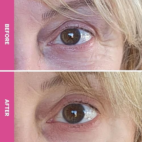 PRIMEEYES HYDRATING UNDER EYE CREAM FOR MATURE SKIN REDUCES DARK CIRCLES WRINKLES
