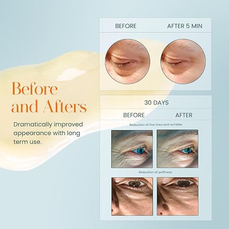 HYLUNIA INTENSIVE REPAIR EYE CREAM HYDRATING, FIRMING WITH PEPTIDES, VITAMIN C HYALURONIC ACID