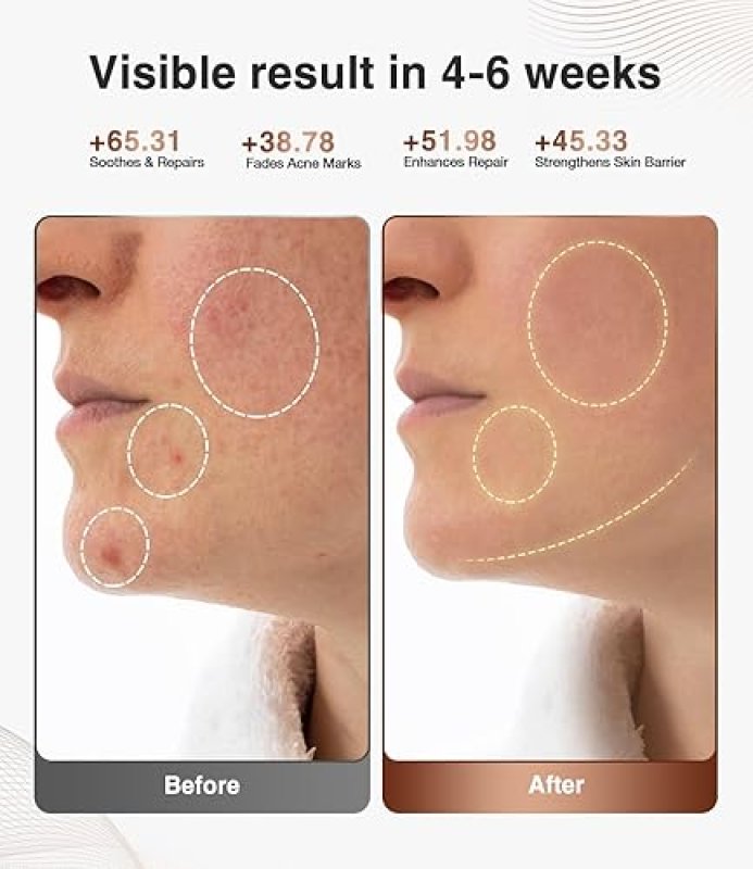 JOVS WIRELESS LED LIGHT THERAPY FACE MASK, 4 MODES PORTABLE SKIN CARE DEVICE, LIGHT BLUE