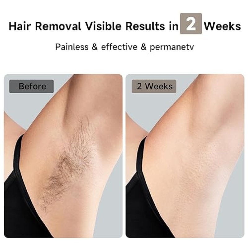 JOVS LASER HAIR REMOVAL DEVICE WITH SAPPHIRE COOLING, 3-IN-1 SKIN REJUVENATION 8 MODES