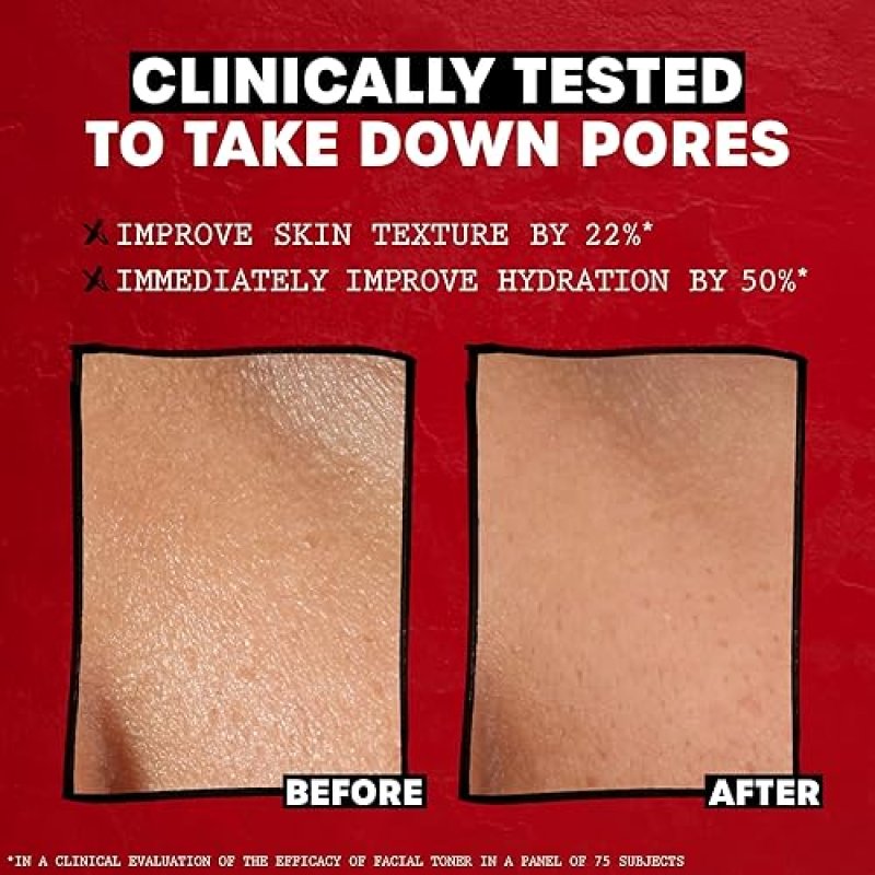 THAYERS ALCOHOL-FREE ROSE PETAL WITCH HAZEL TONER 12OZ HYDRATING, SOOTHING, ALL SKIN TYPES