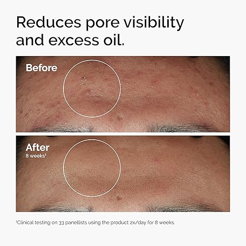 THE ORDINARY SERUM SET HYALURONIC ACID, NIACINAMIDE, CAFFEINE FOR HYDRATING BRIGHTENING SKIN