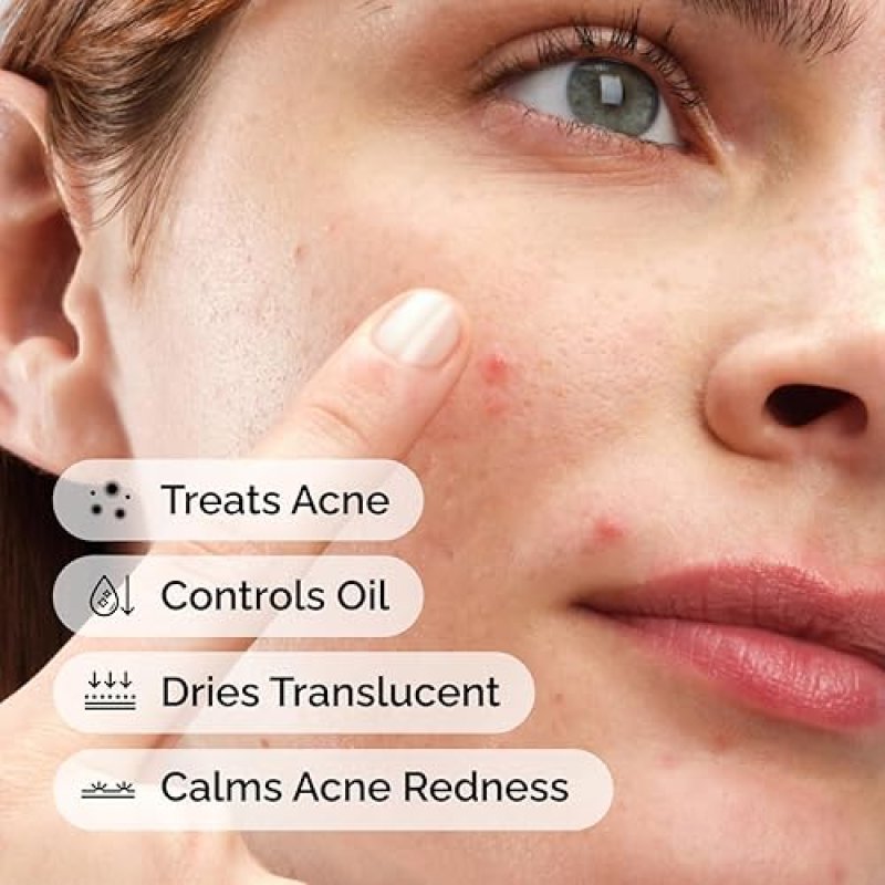 THE ORDINARY SULFUR 10 ACNE SPOT TREATMENT, REDUCES PIMPLES REDNESS, 0.18 OZ POWDER-TO-CREAM