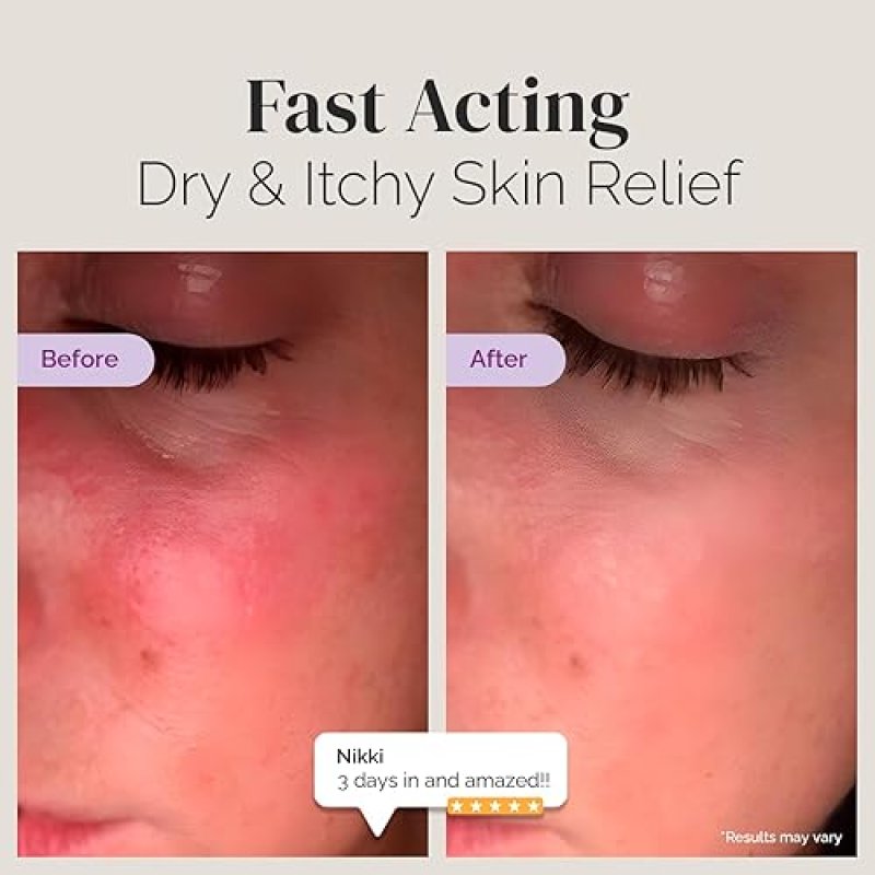 PURIYA ECZEMA CREAM 2OZ NEA ACCEPTED, COLLOIDAL OATMEAL, FRAGRANCE-FREE, ITCHY DRY SKIN RELIEF