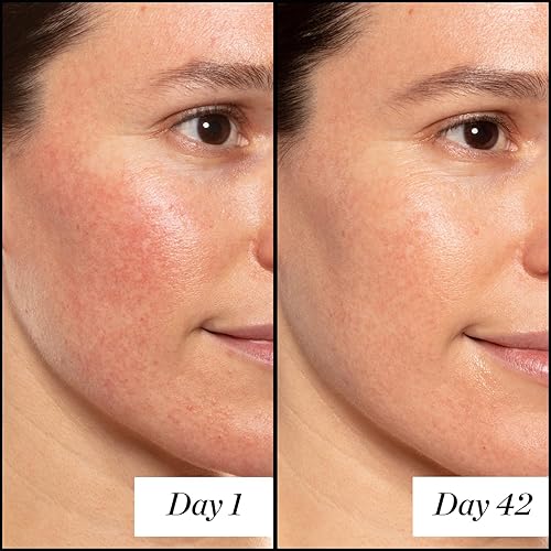 SUNDAY RILEY A HIGH-DOSE RETINOL SERUM FOR ANTI-AGING, FINE LINES WRINKLES, 30ML