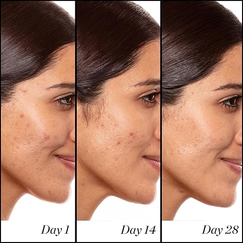 SUNDAY RILEY A HIGH-DOSE RETINOL SERUM FOR ANTI-AGING, FINE LINES WRINKLES, 30ML