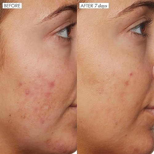 SUNDAY RILEY B3 NICE 10 NIACINAMIDE FACE SERUM 1OZ BRIGHTENING PORE MINIMIZING TREATMENT
