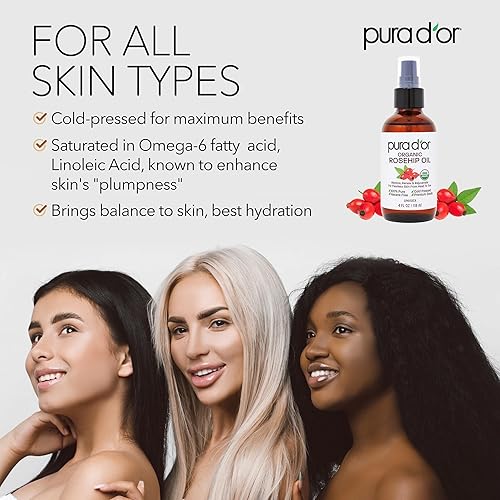PURA DOR ORGANIC ROSEHIP SEED OIL 4OZ 100 PURE, COLD PRESSED, USDA, SCAR STRETCH MARK CARE
