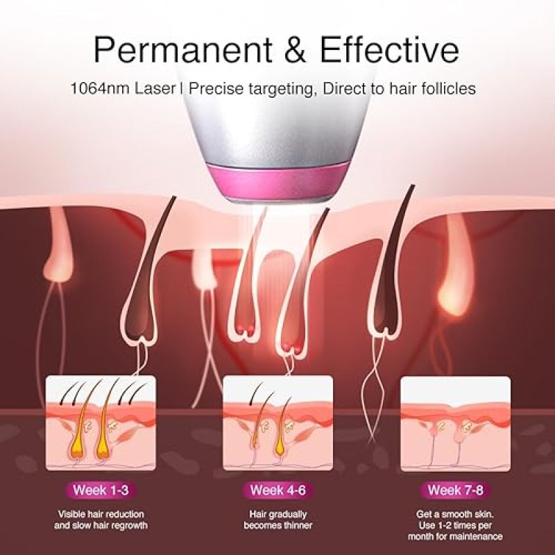 DERMRAYS 1064NM DIODE LASER HAIR REMOVAL FOR DARK MELANATED SKIN, PERMANENT REDUCTION