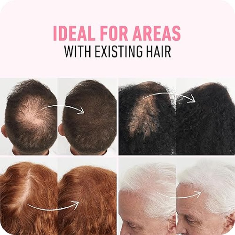 BOLDIFY HAIR FIBERS 28G - THICKEN THINNING HAIR INSTANTLY, 14 SHADES FOR MEN WOMEN, BLACK