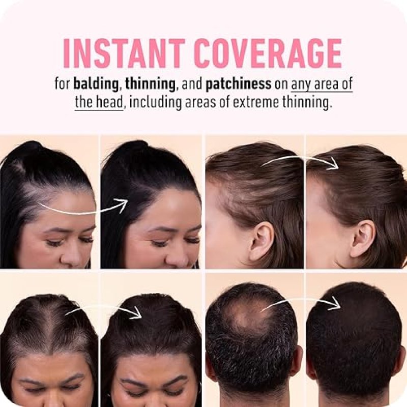BOLDIFY HAIRLINE POWDER DARK AUBURN - GRAY COVERAGE ROOT TOUCH UP BALD SPOT CONCEALER
