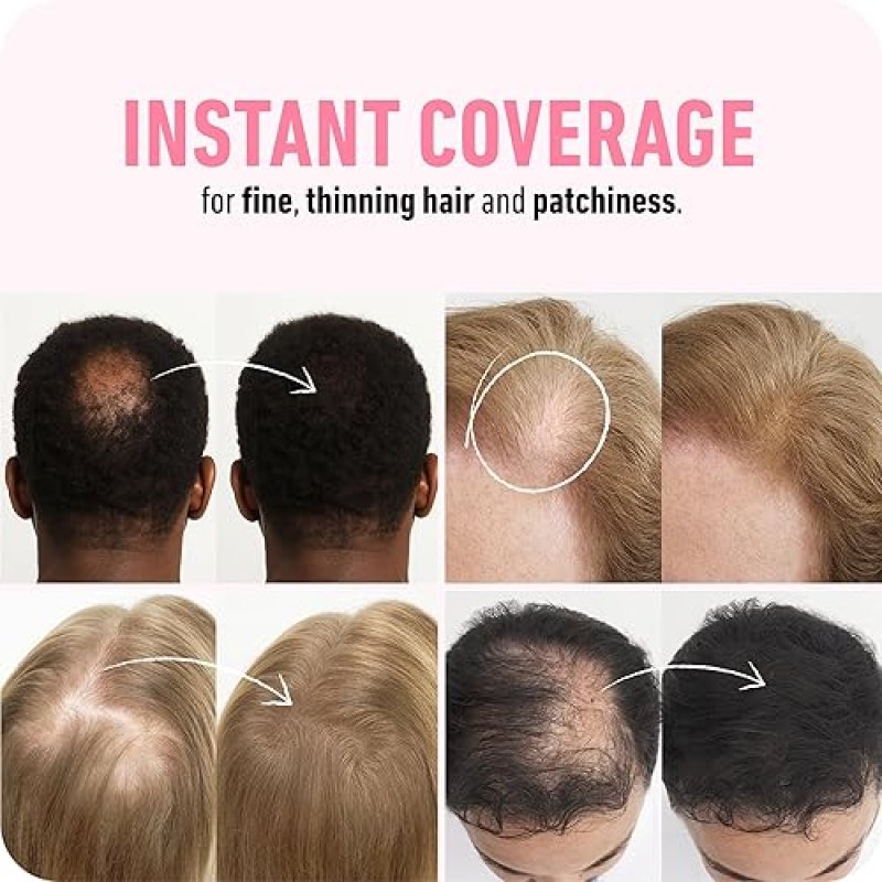 BOLDIFY HAIR FIBERS 28G THICKER, FULLER HAIR INSTANTLY 14 SHADES FOR MEN WOMEN, BLACK