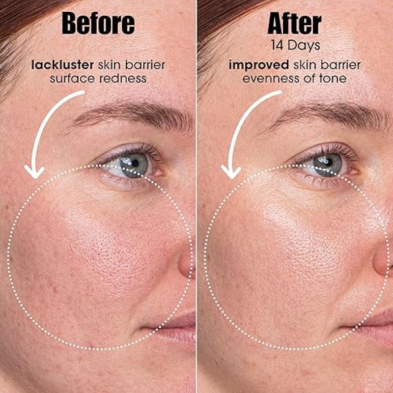 SUNDAY RILEY A.I. ADAPTIVE RETINOID SERUM FOR BLEMISH-PRONE SKIN CLEAR, SMOOTH COMPLEXION