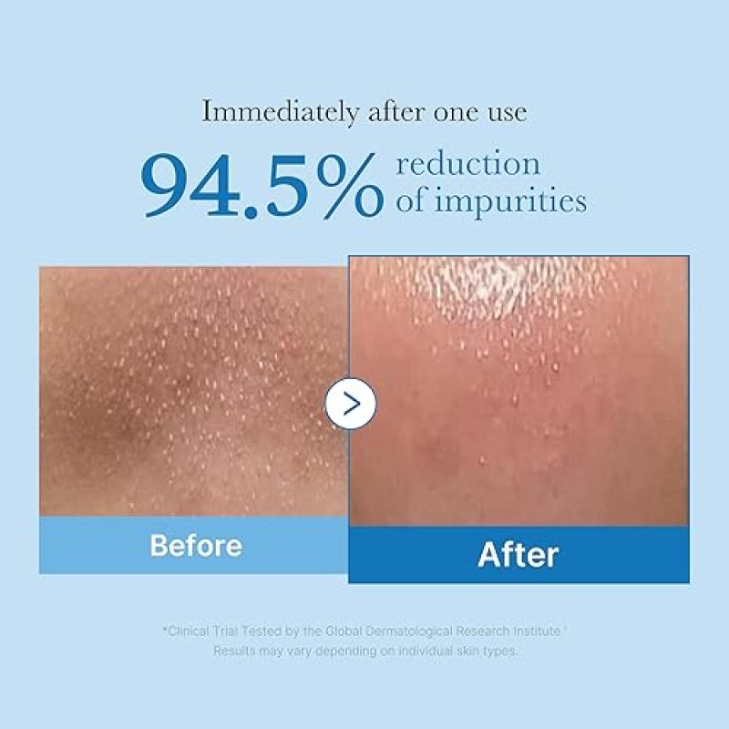 MEDICUBE ZERO PORE BLACKHEAD CLEANSING OIL - GENTLE MAKEUP REMOVER MOISTURIZING CLEANSER 205ML